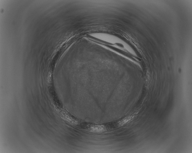 X0000081470355200702021838