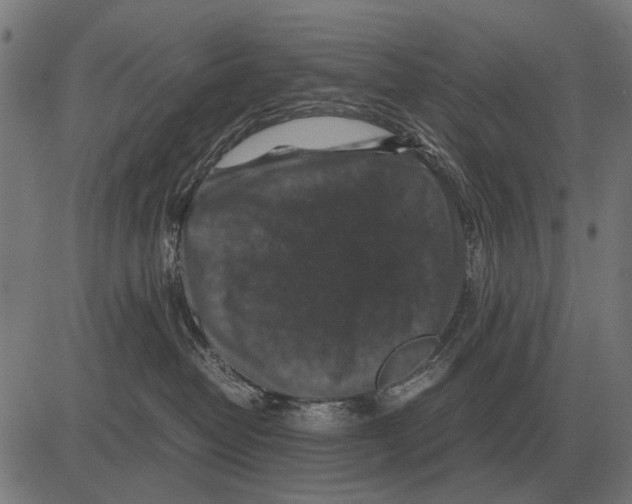 X0000081470382200702021838