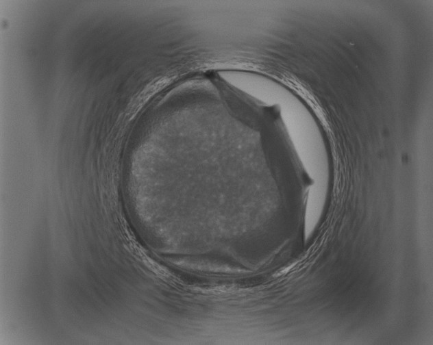 X0000081470385200702021838