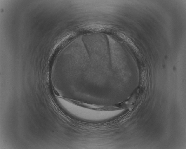 X0000081470399200702021837