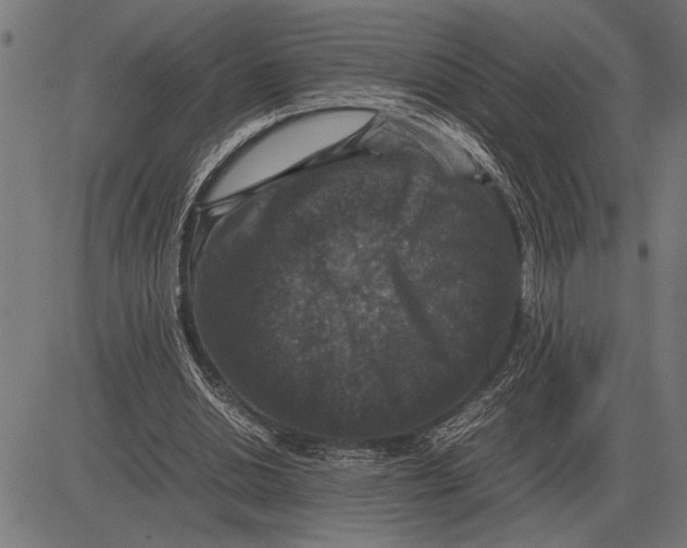 X0000081470438200702021836