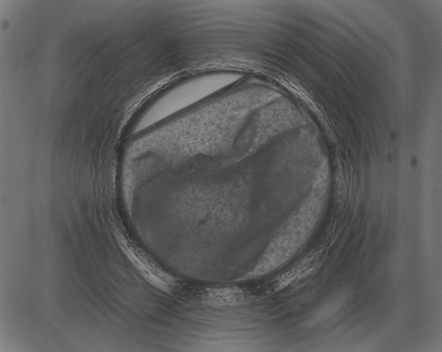 X0000081470446200702021836