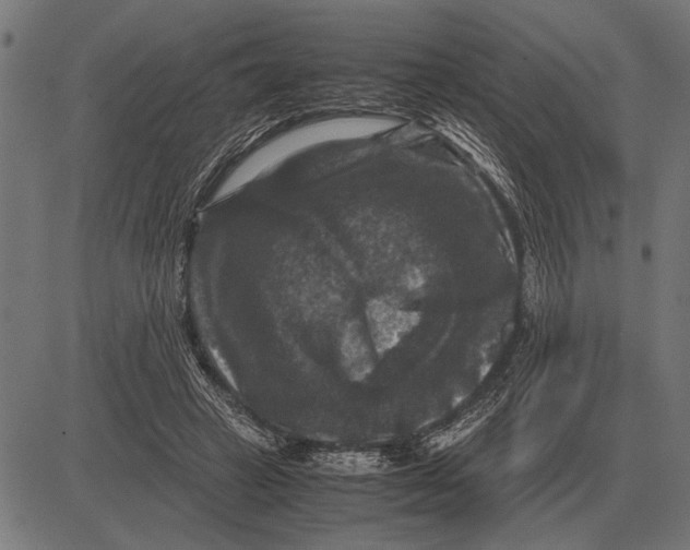 X0000081470449200702021836