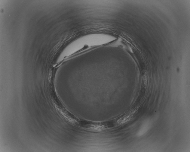 X0000081470458200702021836