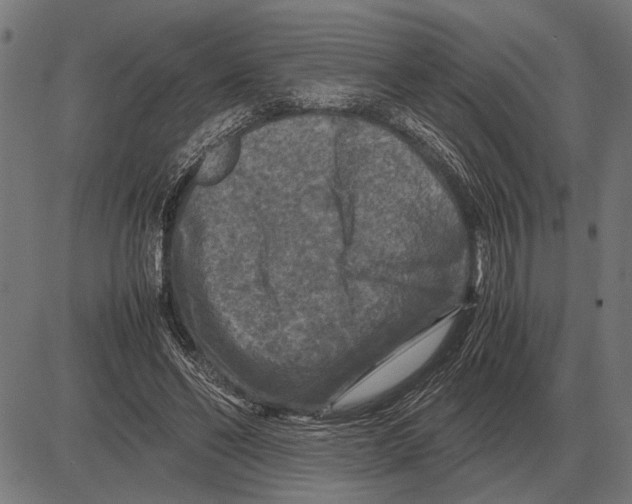 X0000081470494200702021836