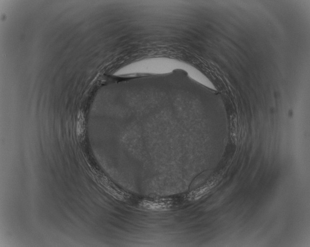 X0000081470563200702021835