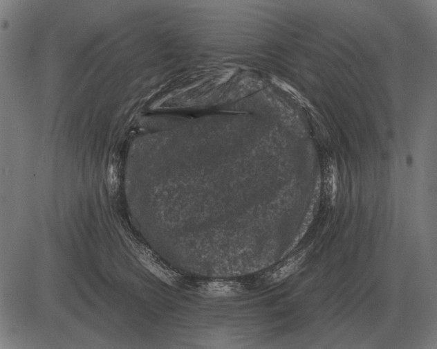 X0000081470566200702021835