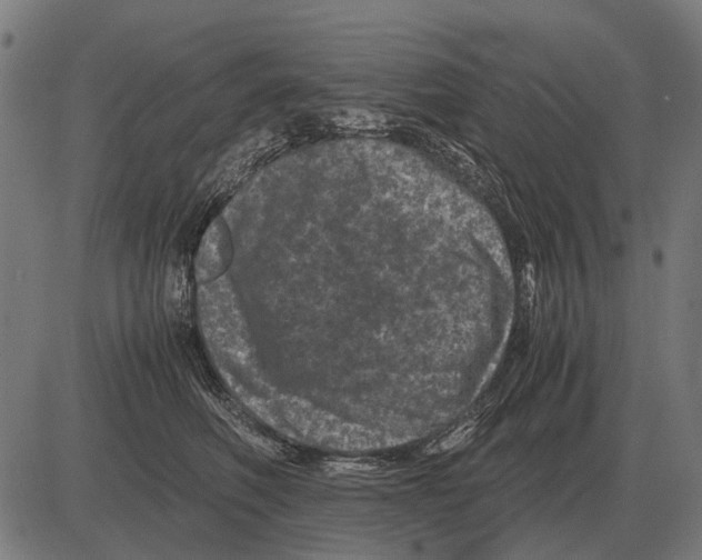 X0000081470614200702021834