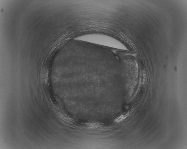 X0000081470693200702021833