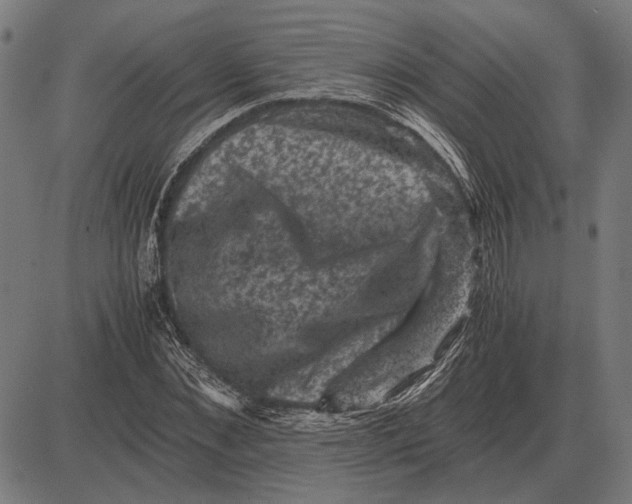 X0000081470876200702021830