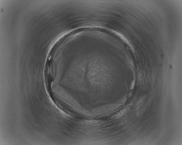 X0000081470943200702021829