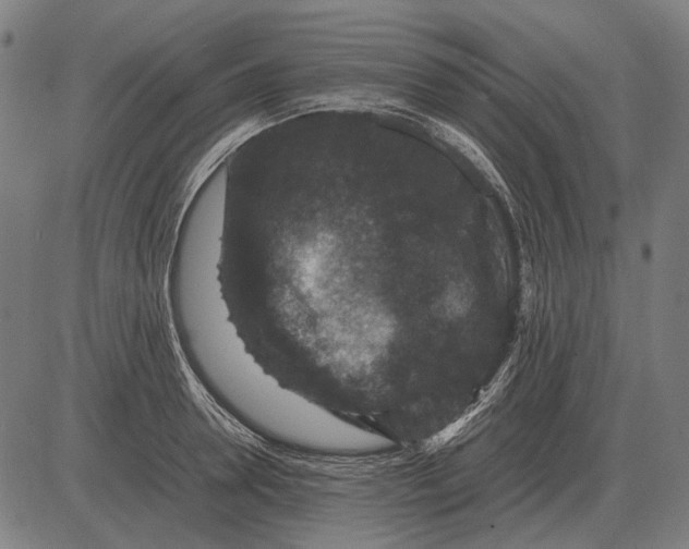 X0000081470946200702021829