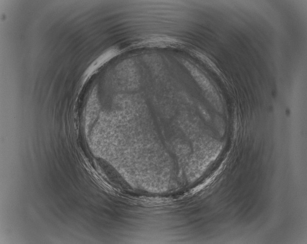 X0000081471018200702021827