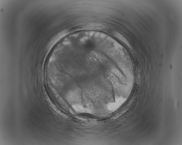 X0000081471087200702021826