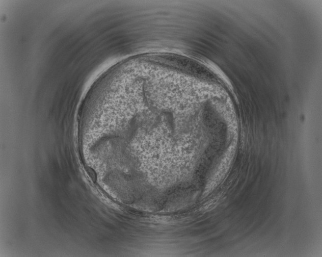 X0000081471096200702021826