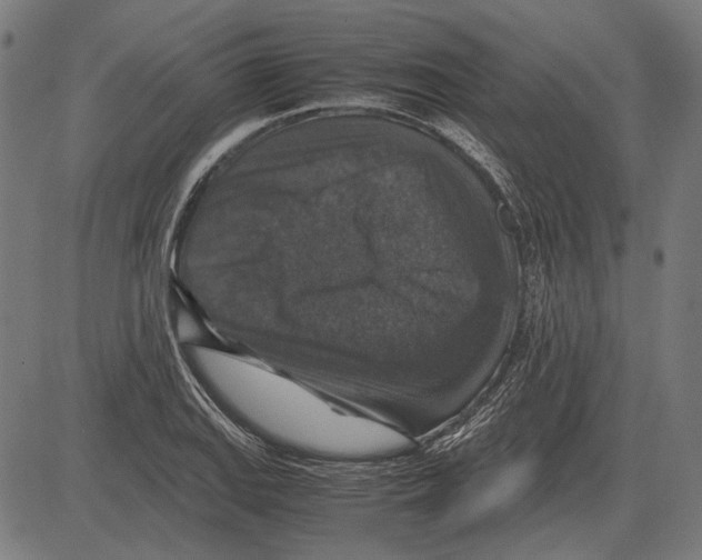 X0000081471127200702021825