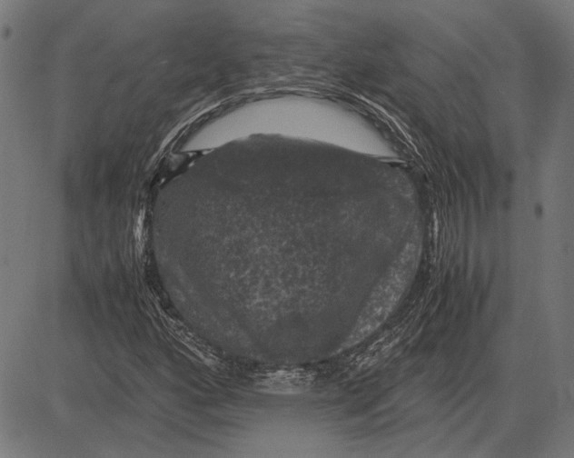 X0000081471160200702021825