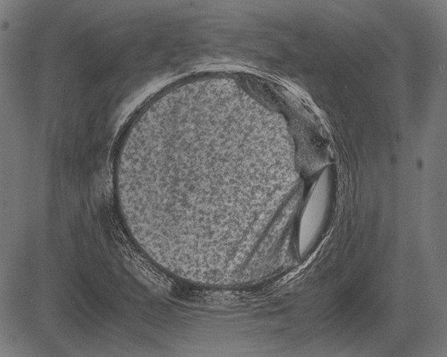 X0000081471167200702021825