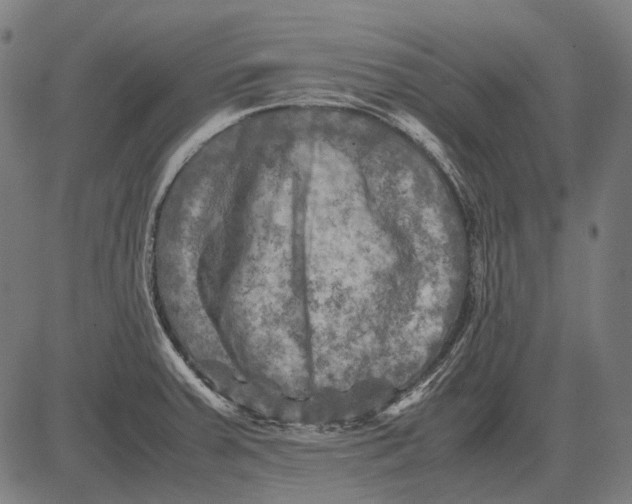 X0000081471379200702021821