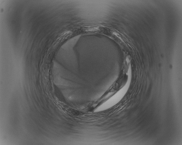 X0000081471441200702021820