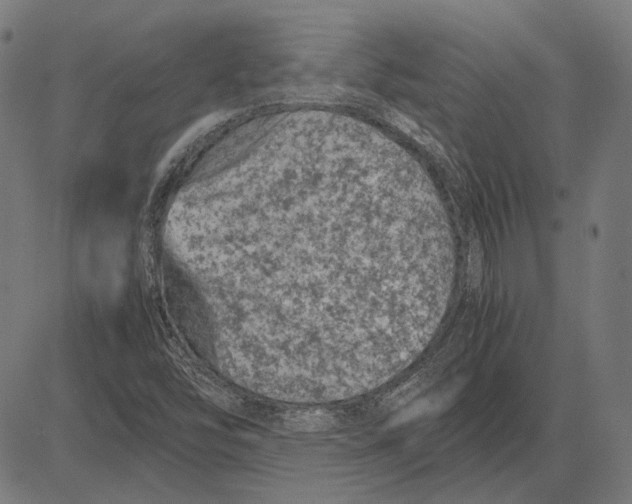 X0000081471454200702021820