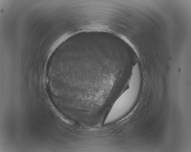 X0000081471469200702021820