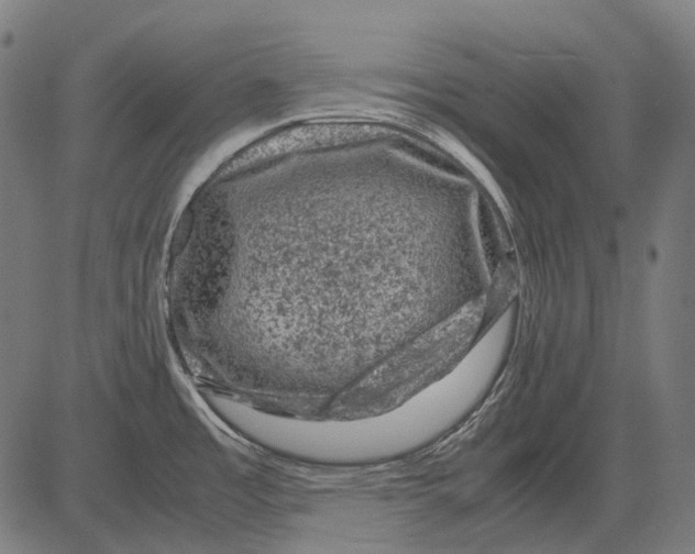 X0000081471485200702021820