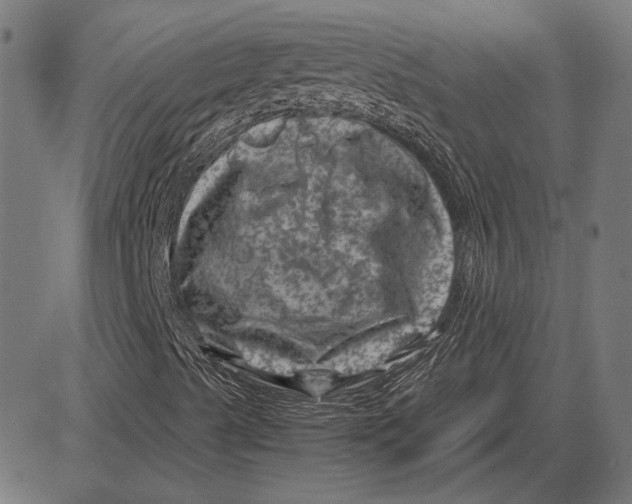 X0000081471489200702021819