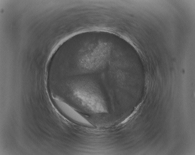 X0000081471508200702021819