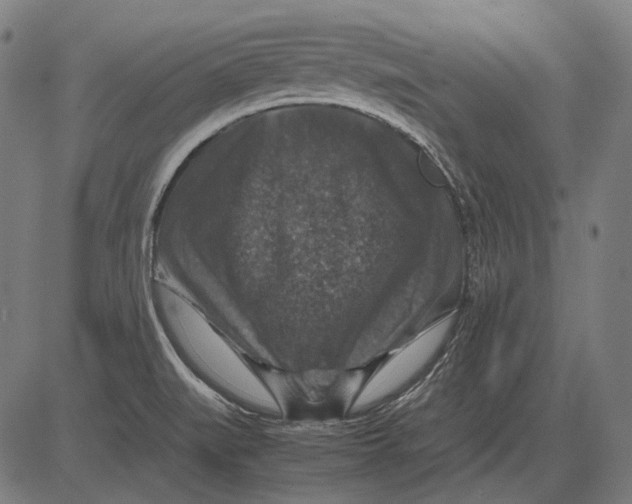 X0000081471519200702021819