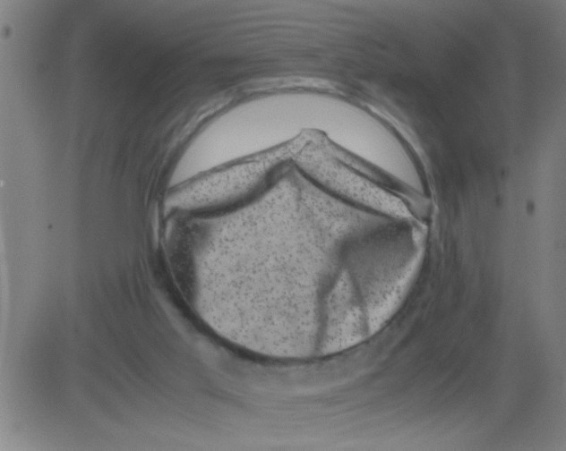 X0000081470013200702092351