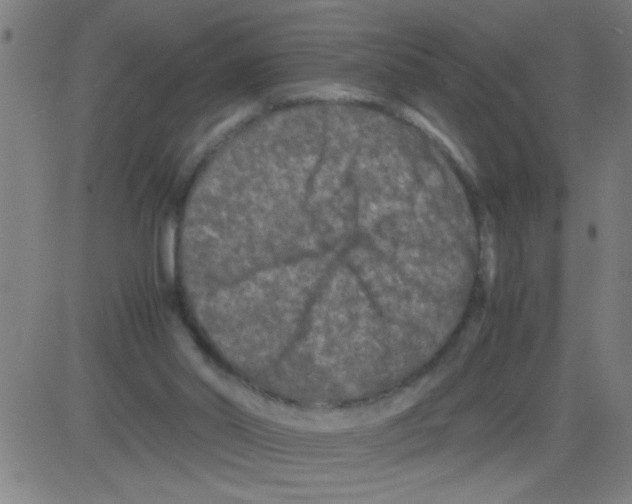 X0000081470014200702092351