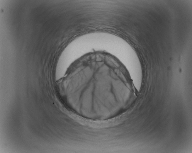 X0000081470039200702092351