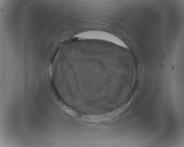 X0000081470041200702092351