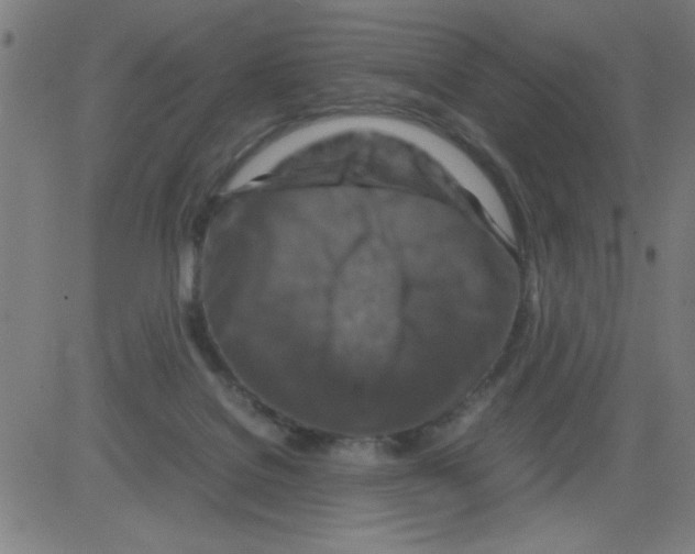 X0000081470076200702092350