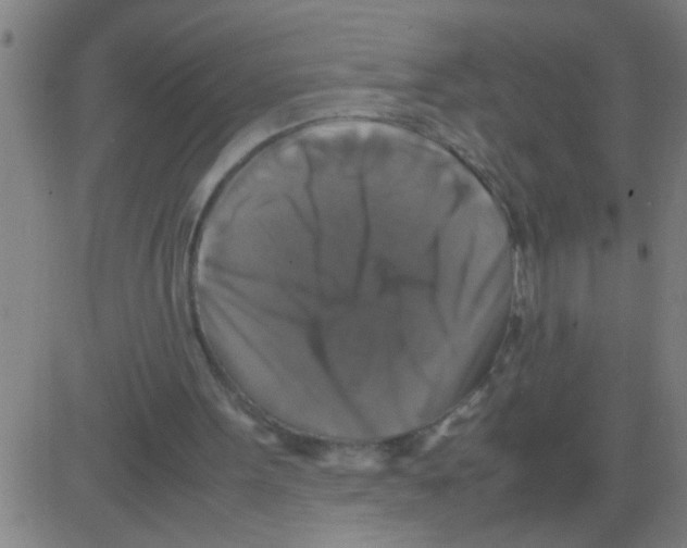 X0000081470099200702092350