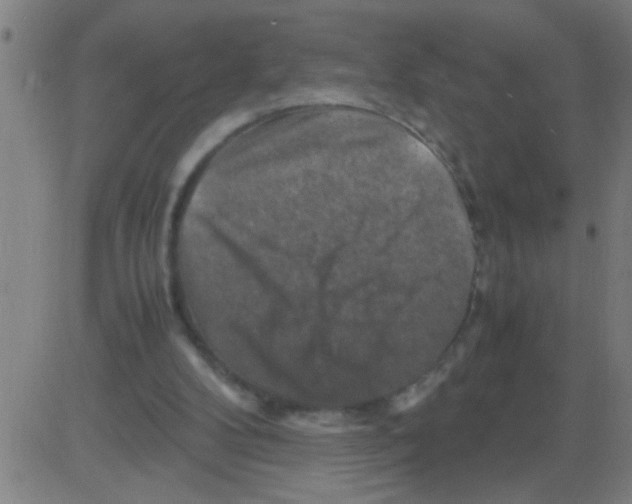 X0000081470104200702092350