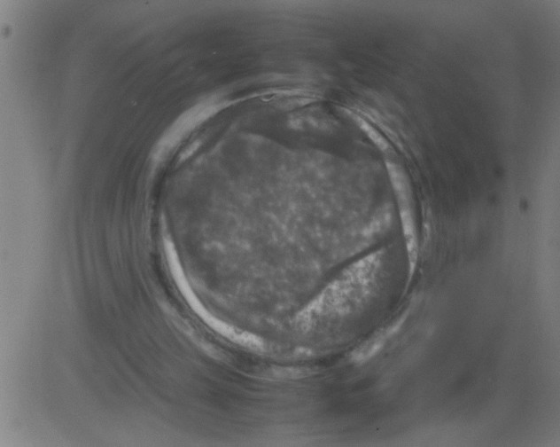 X0000081470149200702092348