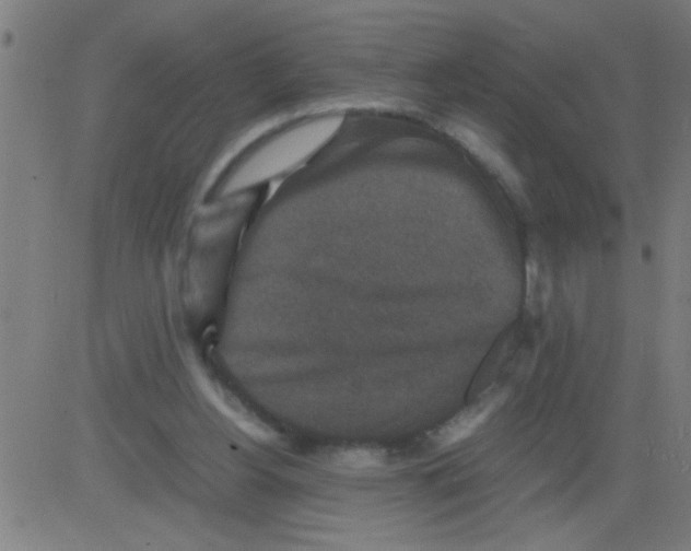 X0000081470156200702092348