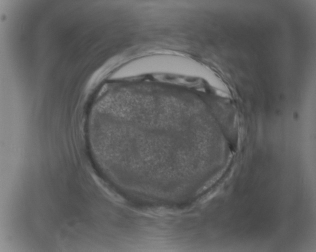 X0000081470197200702092348