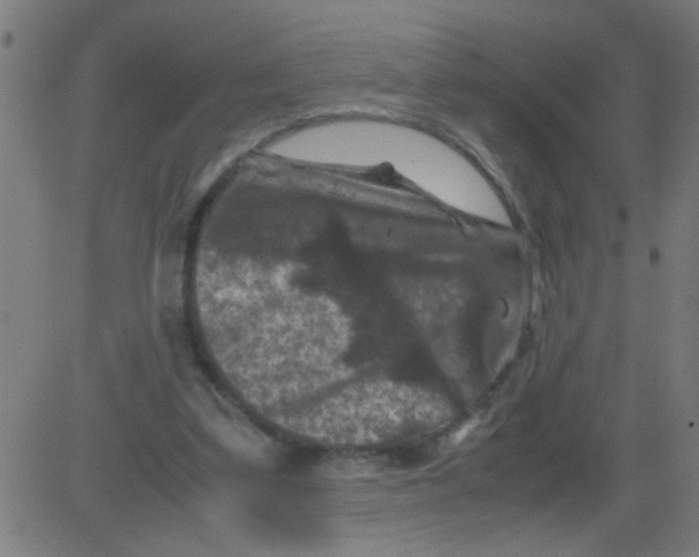 X0000081470299200702092347