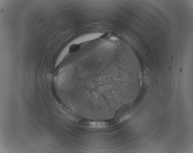 X0000081470371200702092346