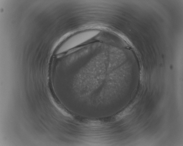 X0000081470438200702092344