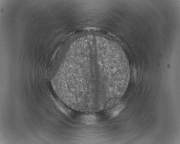 X0000081470668200702092341