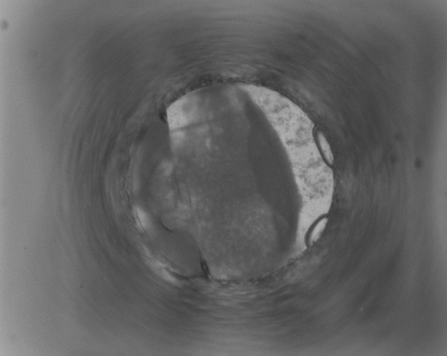 X0000081470817200702092337