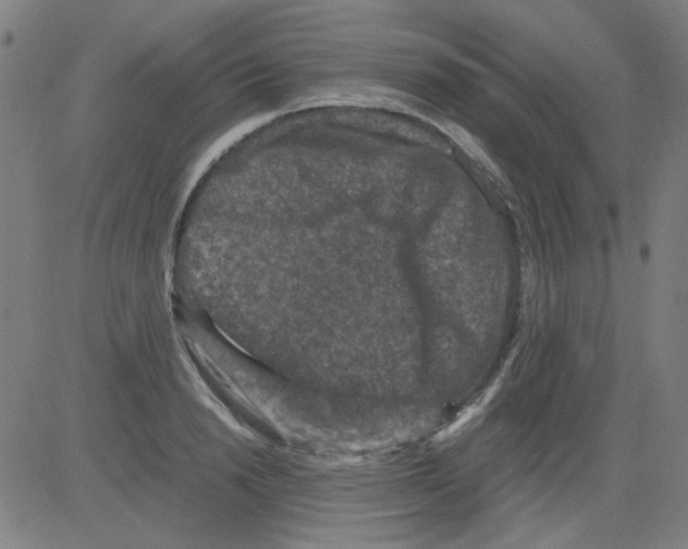 X0000081470846200702092338