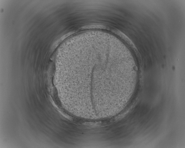 X0000081470937200702092336