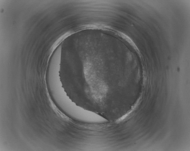 X0000081470946200702092336