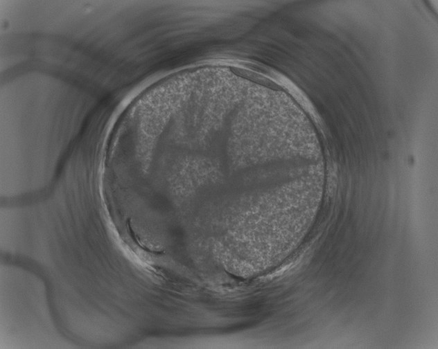 X0000081470955200702092336