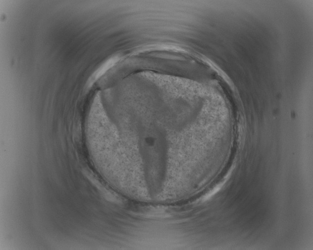 X0000081470969200702092336